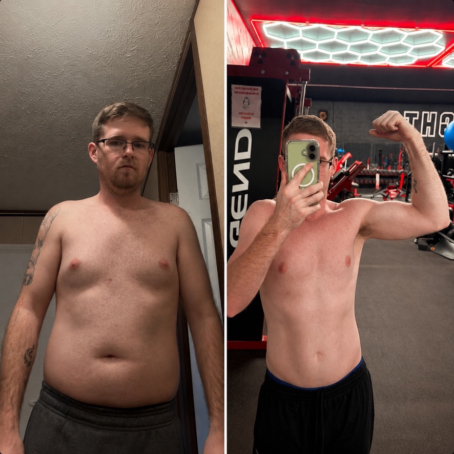 Before and after weight-loss transformation under the hex lights